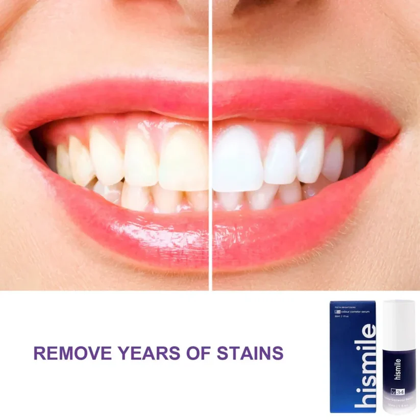 HiSmile V34 Purple Teeth Whitening Serum – Instant Stain Removal & Brighter Smile